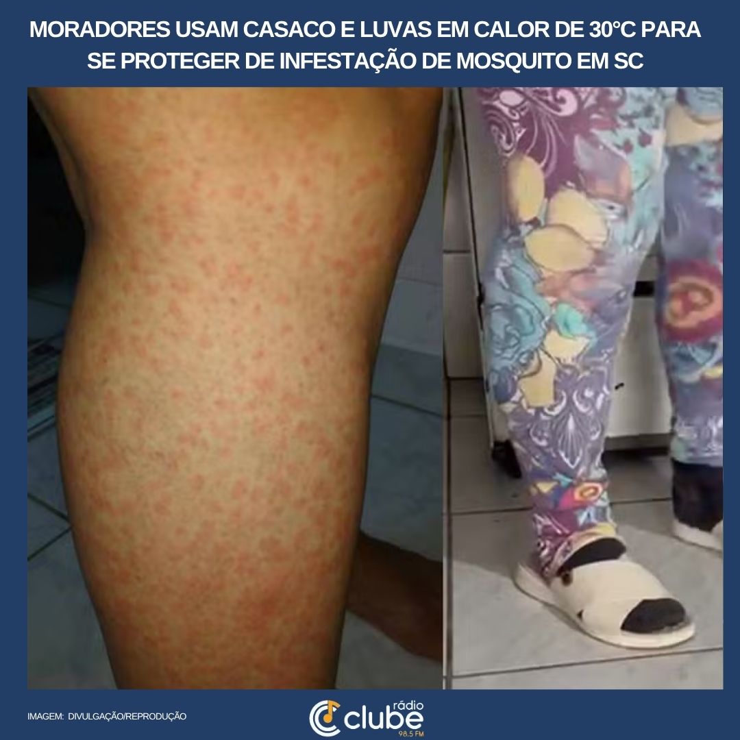 Moradores usam casaco e luvas em calor de 30°C para se proteger de infestação de mosquito em SC