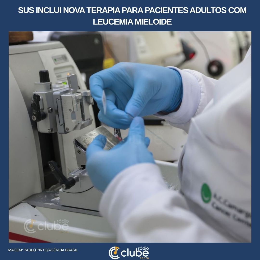 SUS inclui nova terapia para pacientes adultos com leucemia mieloide