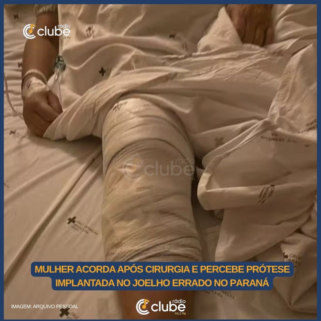 Mulher acorda após cirurgia e percebe implante de prótese no joelho errado, no Paraná